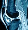 Orthopedics