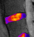 MMI conducts quantitative analyses of spinal disc “health” and “quality” using an MRI technique called relaxation mapping. Relaxation mapping is common in clinical trials of treatments for disc repair and regeneration.