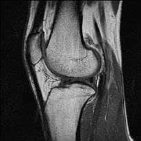 Measuring the effect of OA in the knee joint requires specialized expertise.