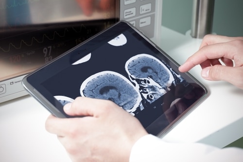 Novel devices can benefit from clinical data to find a more welcome market reception.