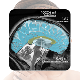 Brain mobile image