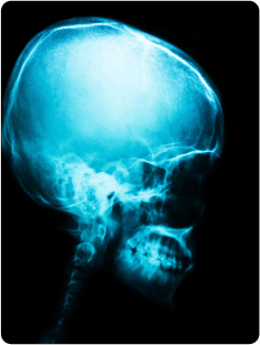 head x-ray