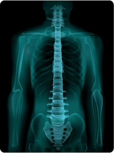 body x-ray