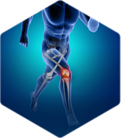 Orthopedics