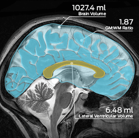 TA_Neuro