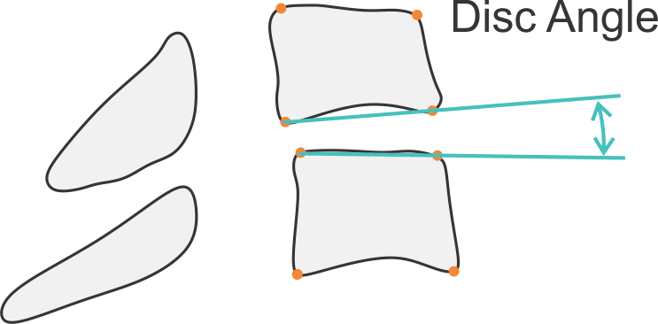 cervicaldiscangle