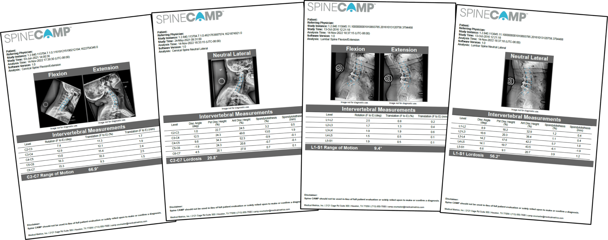 Cervical & Lumbar Spine Analysis