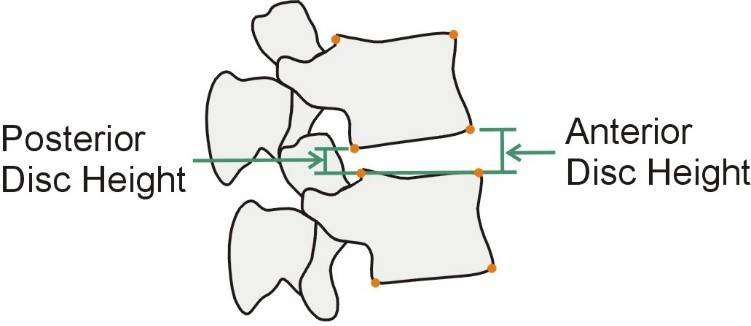 lumbardischeight1